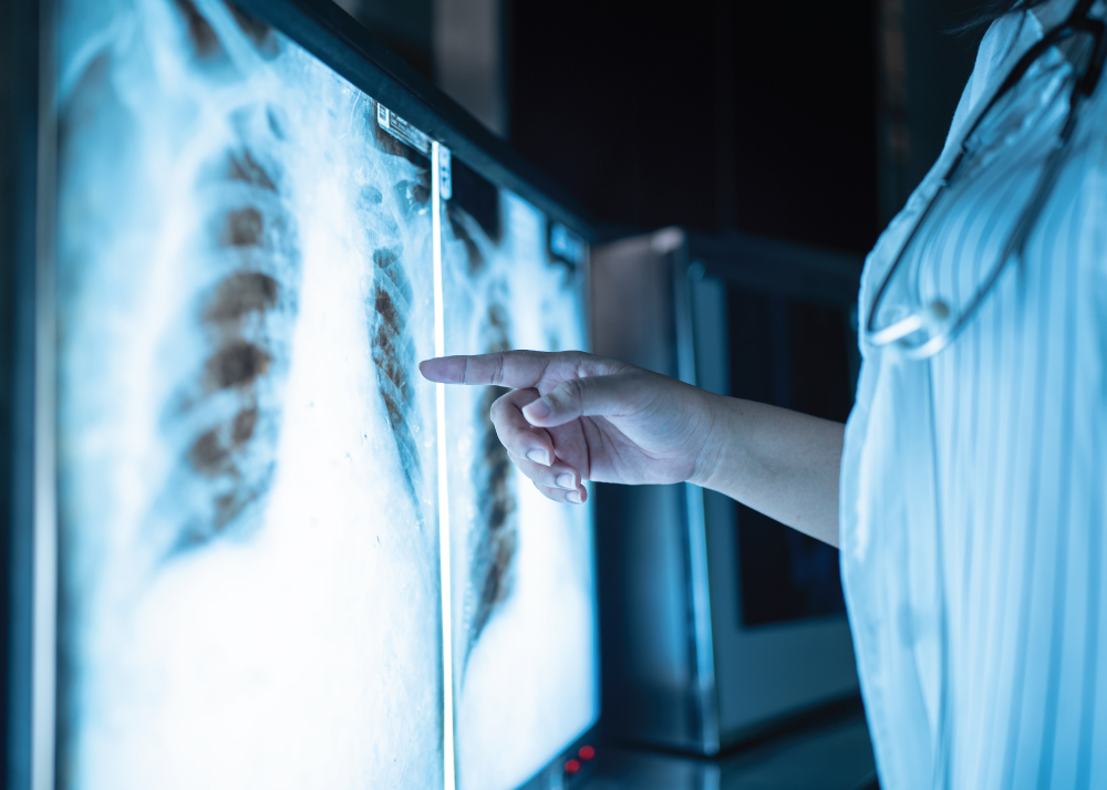 Intervention Radiology