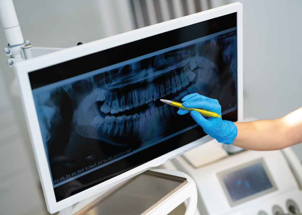 Maxillofacial Surgery