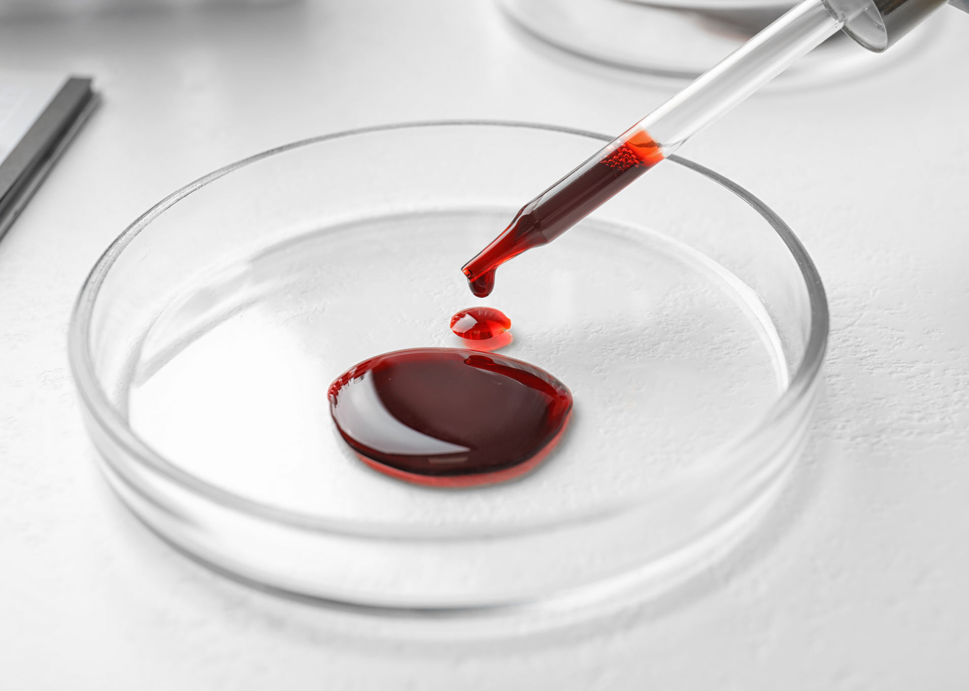 Hemato-Oncology-Adult