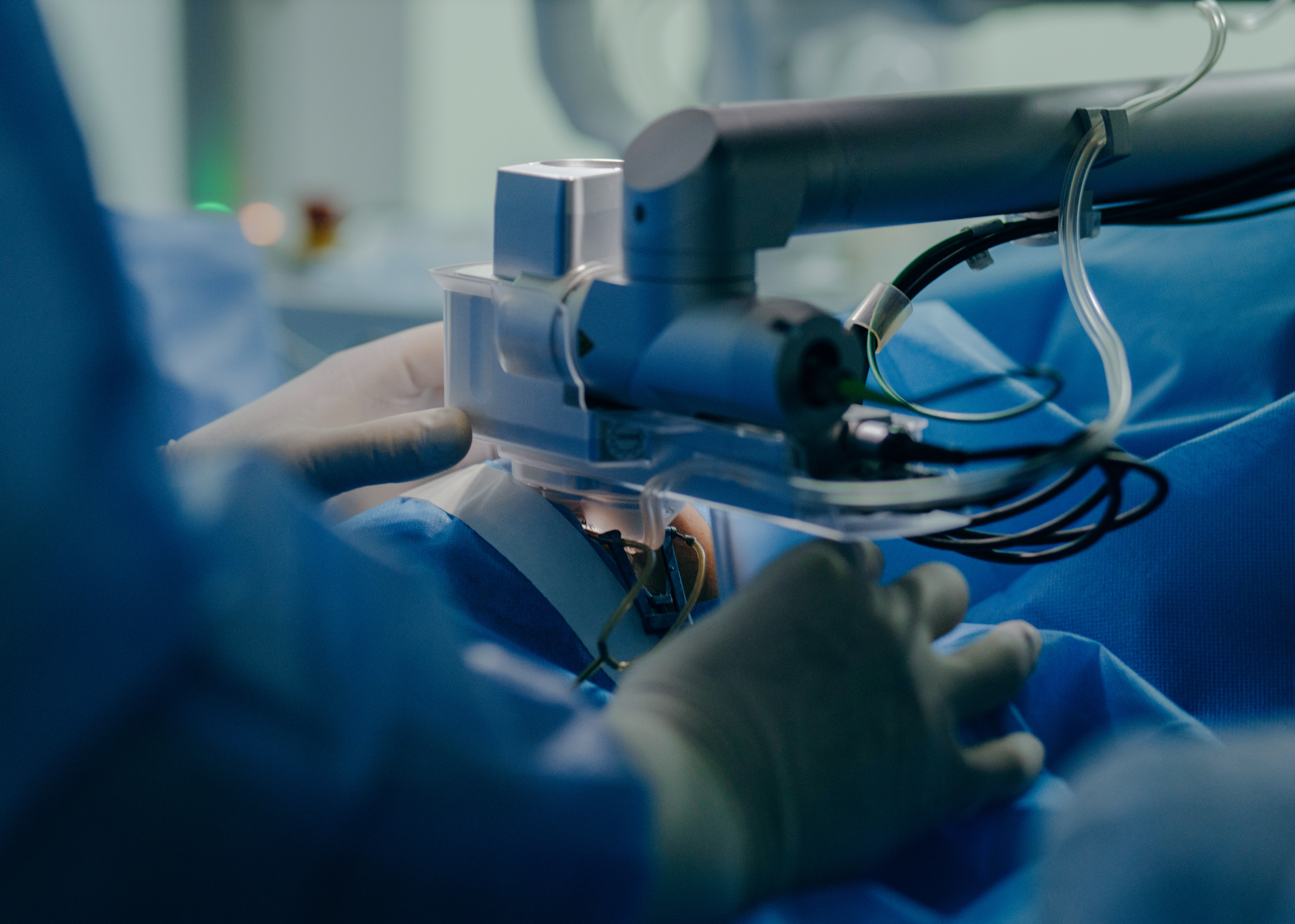 Gynecology Surgeries at the Robotic Surgeries Specialized Center 