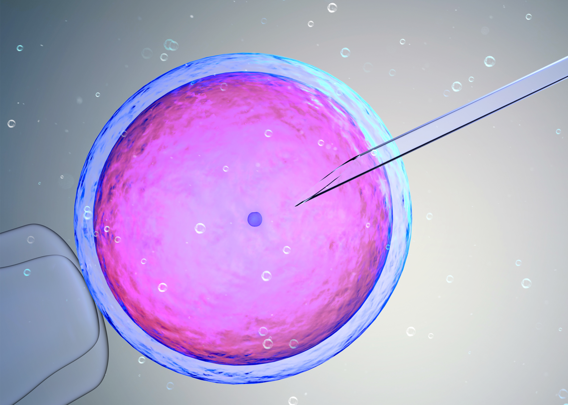 Intrauterine Insemination (IUI) - Artificial Insemination
