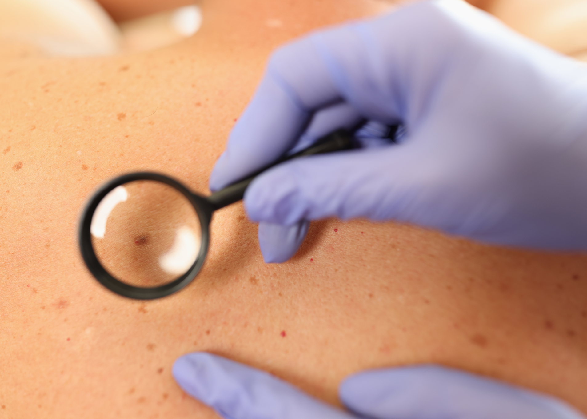 Clinical skin conditions 