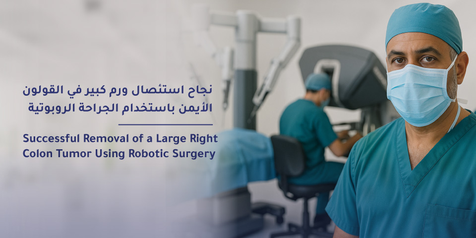 Successful Removal of a Large Colon Tumor Using Robotic Surgery at Mouwasat Hospital – Khobar 